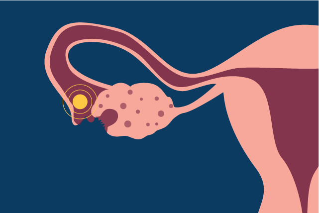 Ovarian egg traveling in fallopian tubes during ovulation representing when you ovulate.