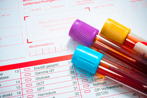 Vials of blood in front of a medical form to represent genetic testing before pregnancy.